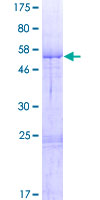 ab162766 on a 12.5% SDS-PAGE stained with Coomassie Blue.