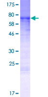 ab166325 on a 12.5% SDS-PAGE stained with Coomassie Blue.