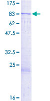 ab153520 on a 12.5% SDS-PAGE stained with Coomassie Blue.