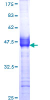 ab152277 on a 12.5% SDS-PAGE stained with Coomassie Blue.