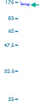 ab153030 on a 12.5% SDS-PAGE stained with Coomassie Blue.