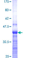 ab153093 on a 12.5% SDS-PAGE stained with Coomassie Blue.