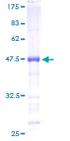 ab162356 on a 12.5% SDS-PAGE stained with Coomassie Blue.