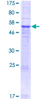 ab162018 on a 12.5% SDS-PAGE stained with Coomassie Blue.