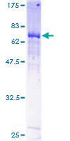 ab153303 on a 12.5% SDS-PAGE stained with Coomassie Blue.