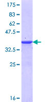 ab164879 on a 12.5% SDS-PAGE stained with Coomassie Blue.