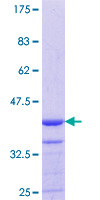 ab158943 on a 12.5% SDS-PAGE stained with Coomassie Blue.