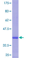 ab165456 on a 12.5% SDS-PAGE stained with Coomassie Blue.