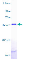 ab158937 on a 12.5% SDS-PAGE stained with Coomassie Blue.