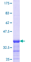ab158938 on a 12.5% SDS-PAGE stained with Coomassie Blue.