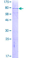 ab160513 on a 12.5% SDS-PAGE stained with Coomassie Blue.