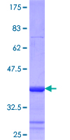 ab160514 on a 12.5% SDS-PAGE stained with Coomassie Blue.