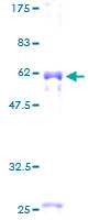 ab162665 on a 12.5% SDS-PAGE stained with Coomassie Blue.