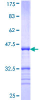 ab164632 on a 12.5% SDS-PAGE stained with Coomassie Blue.
