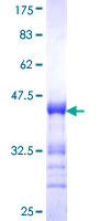 ab161513 on a 12.5% SDS-PAGE stained with Coomassie Blue.