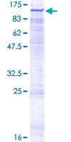 ab163006 on a 12.5% SDS-PAGE stained with Coomassie Blue.