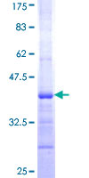 ab163007 on a 12.5% SDS-PAGE stained with Coomassie Blue.