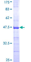 ab162056 on a 12.5% SDS-PAGE stained with Coomassie Blue.