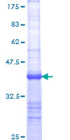 ab158950 on a 12.5% SDS-PAGE stained with Coomassie Blue.