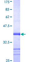ab163165 on a 12.5% SDS-PAGE stained with Coomassie Blue.