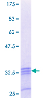 ab166264 on a 12.5% SDS-PAGE stained with Coomassie Blue.
