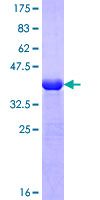ab153643 on a 12.5% SDS-PAGE stained with Coomassie Blue.