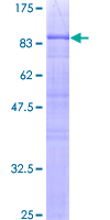 ab158951 on a 12.5% SDS-PAGE stained with Coomassie Blue.
