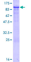 ab158953 on a 12.5% SDS-PAGE stained with Coomassie Blue.