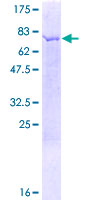 ab153574 on a 12.5% SDS-PAGE stained with Coomassie Blue.