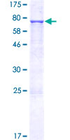 ab163840 on a 12.5% SDS-PAGE stained with Coomassie Blue.