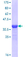 ab164208 on a 12.5% SDS-PAGE stained with Coomassie Blue.