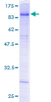 ab158954 on a 12.5% SDS-PAGE stained with Coomassie Blue.