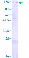 ab158955 on a 12.5% SDS-PAGE stained with Coomassie Blue.
