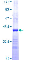 ab163026 on a 12.5% SDS-PAGE stained with Coomassie Blue.