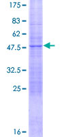 ab163482 on a 12.5% SDS-PAGE stained with Coomassie Blue.