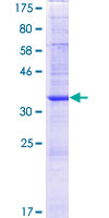 ab162567 on a 12.5% SDS-PAGE stained with Coomassie Blue.