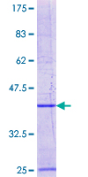 ab162568 on a 12.5% SDS-PAGE stained with Coomassie Blue.