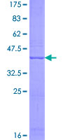 ab166273 on a 12.5% SDS-PAGE stained with Coomassie Blue.