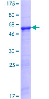 ab161910 on a 12.5% SDS-PAGE stained with Coomassie Blue.