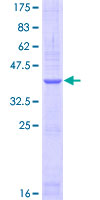 ab112332 run on a 12.5% SDS-PAGE Stained with Coomassie Blue.
