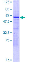 ab161057 on a 12.5% SDS-PAGE stained with Coomassie Blue.