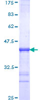 ab161058 on a 12.5% SDS-PAGE stained with Coomassie Blue.