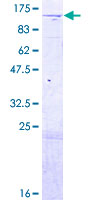 ab162880 on a 12.5% SDS-PAGE stained with Coomassie Blue.
