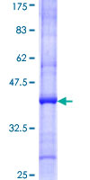 ab162881 on a 12.5% SDS-PAGE stained with Coomassie Blue.