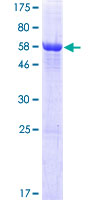 ab166300 on a 12.5% SDS-PAGE stained with Coomassie Blue.