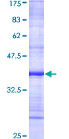 ab153130 on a 12.5% SDS-PAGE stained with Coomassie Blue.