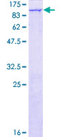 ab162581 on a 12.5% SDS-PAGE stained with Coomassie Blue.