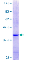 ab162582 on a 12.5% SDS-PAGE stained with Coomassie Blue.