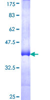 ab163436 on a 12.5% SDS-PAGE stained with Coomassie Blue.