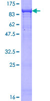 ab159933 on a 12.5% SDS-PAGE stained with Coomassie Blue.
